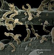 Nanobacteria by Philippa Uwins